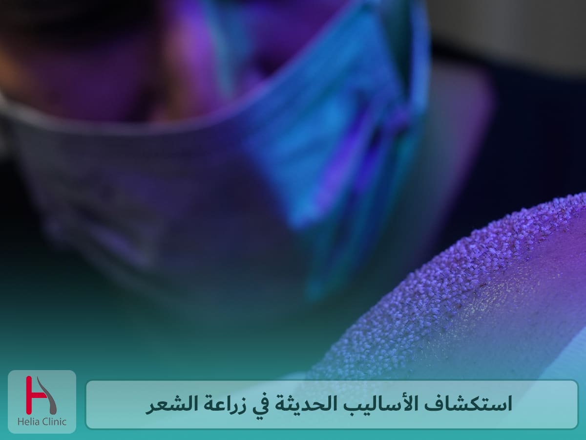 أحدث تقنيات زراعة الشعر