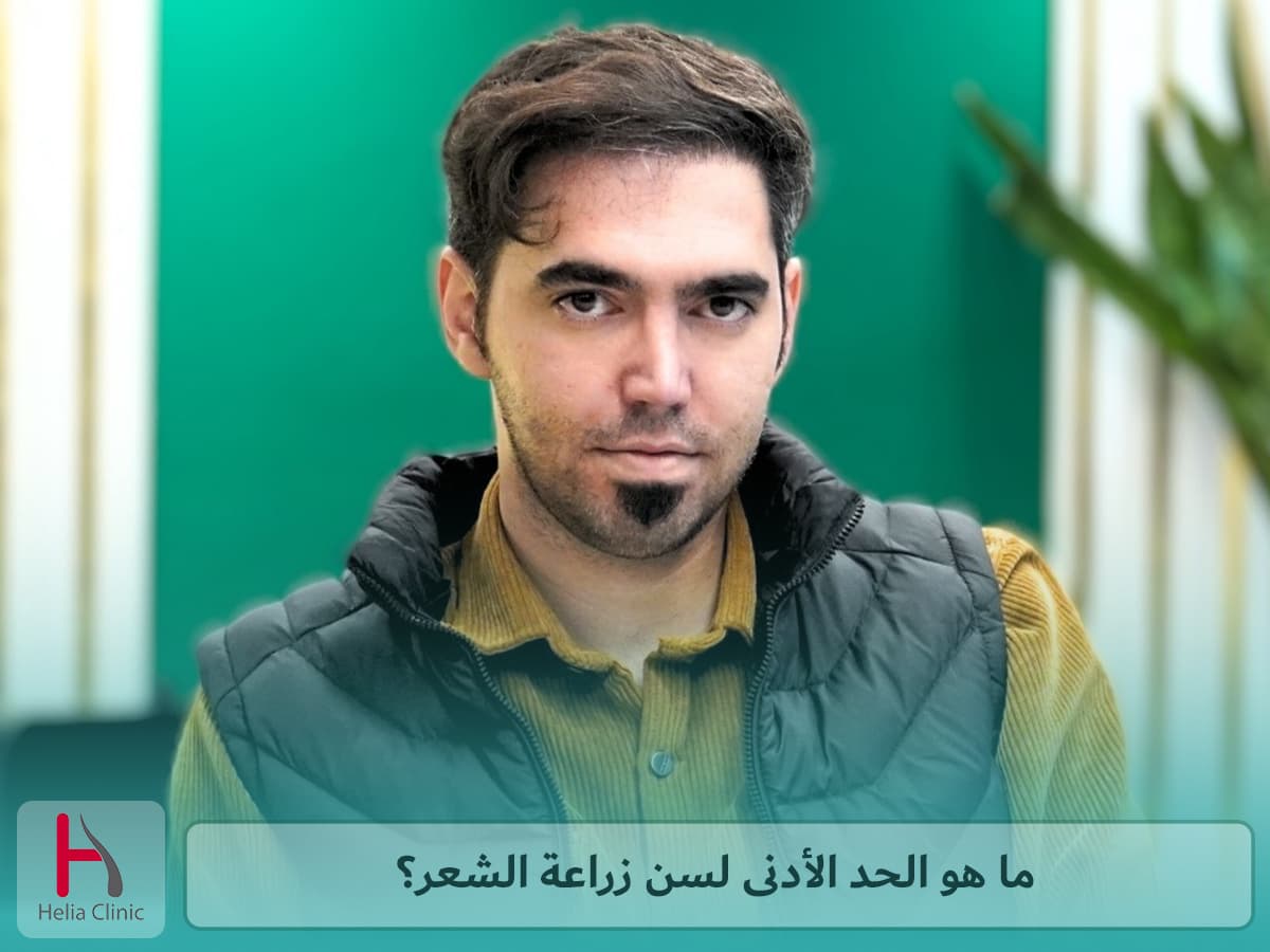 الحد الأدنى لسن زراعة الشعر