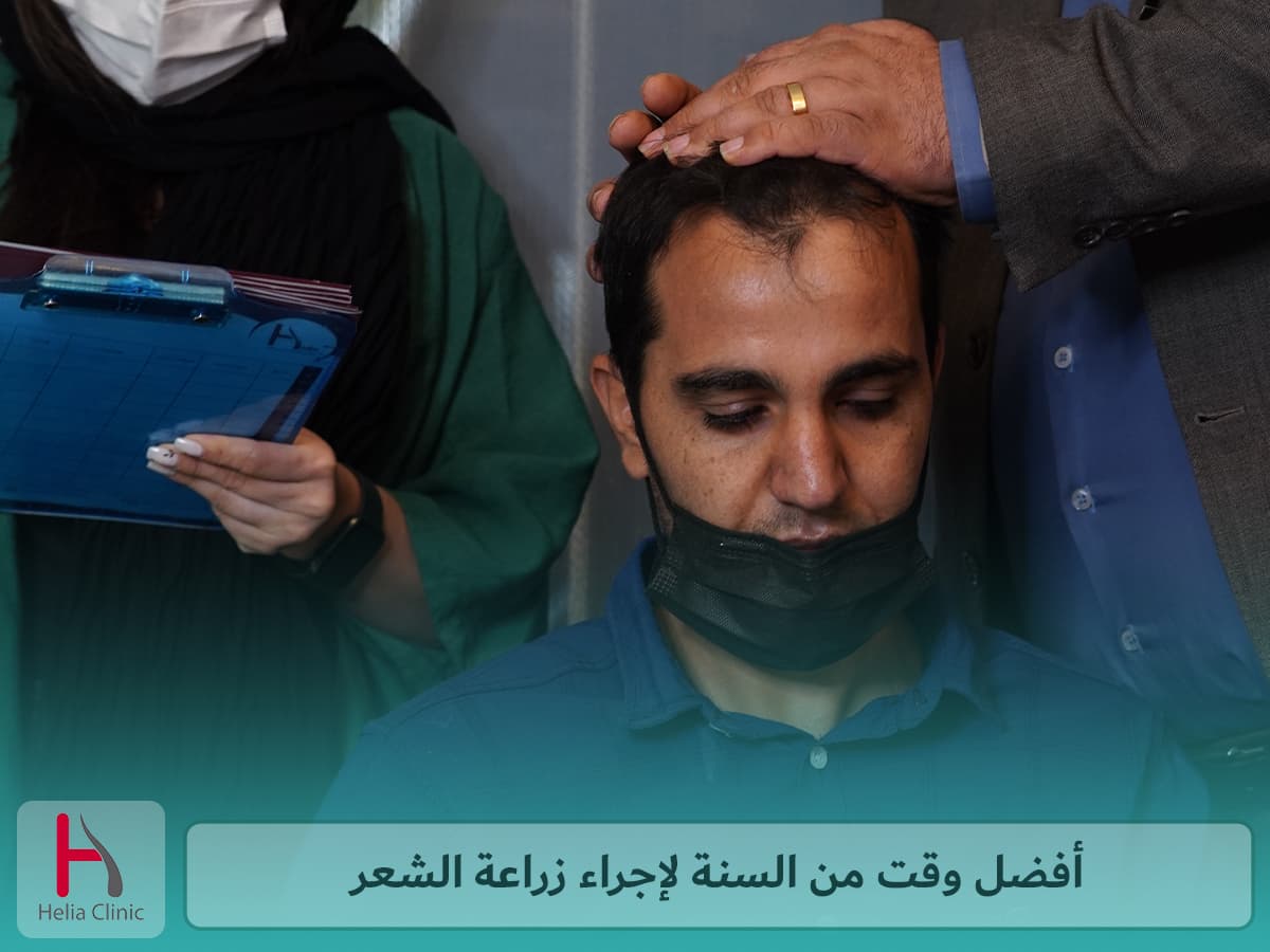 أفضل موسم لزراعة الشعر