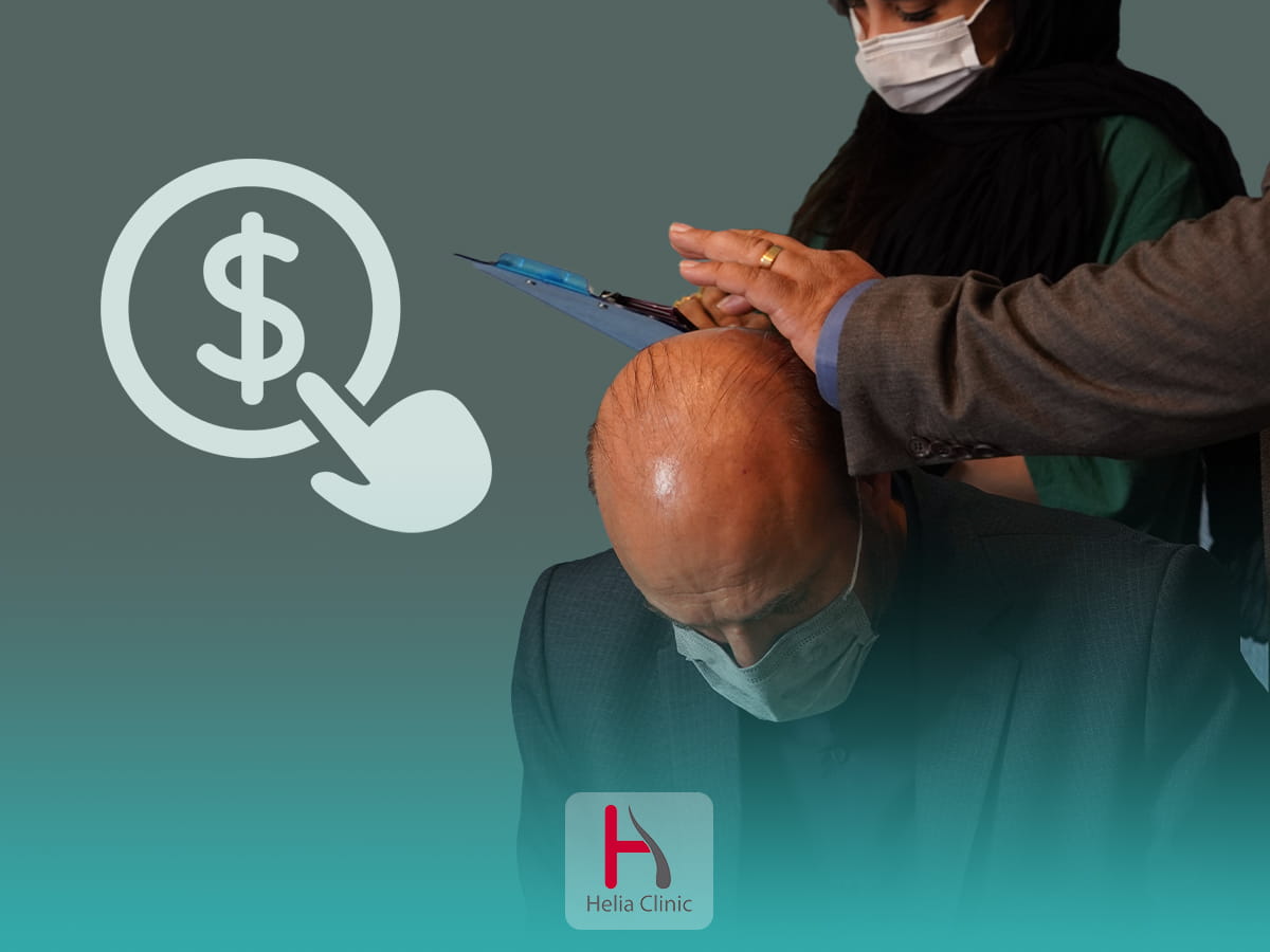 تكلفة وسعر عملية زراعة الشعر