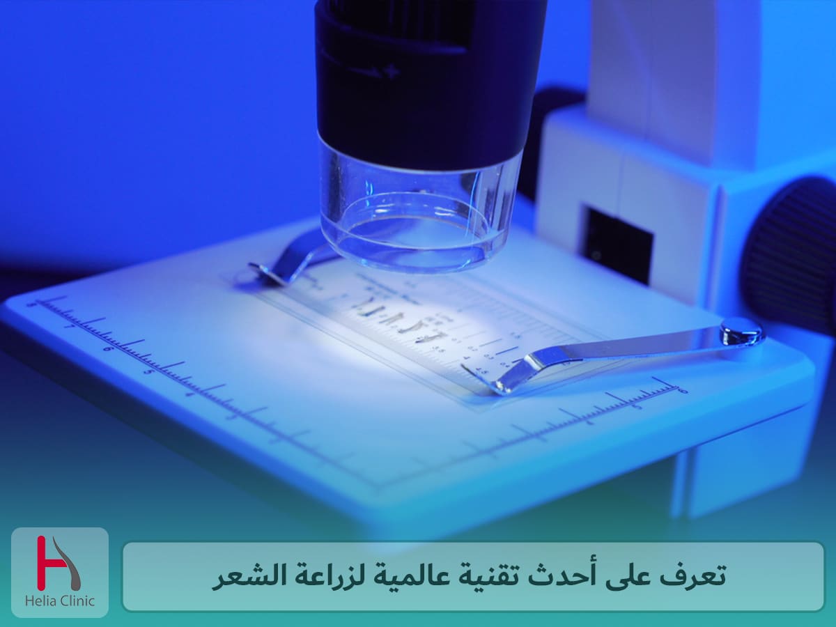أحدث تقنيات زراعة الشعر في العالم