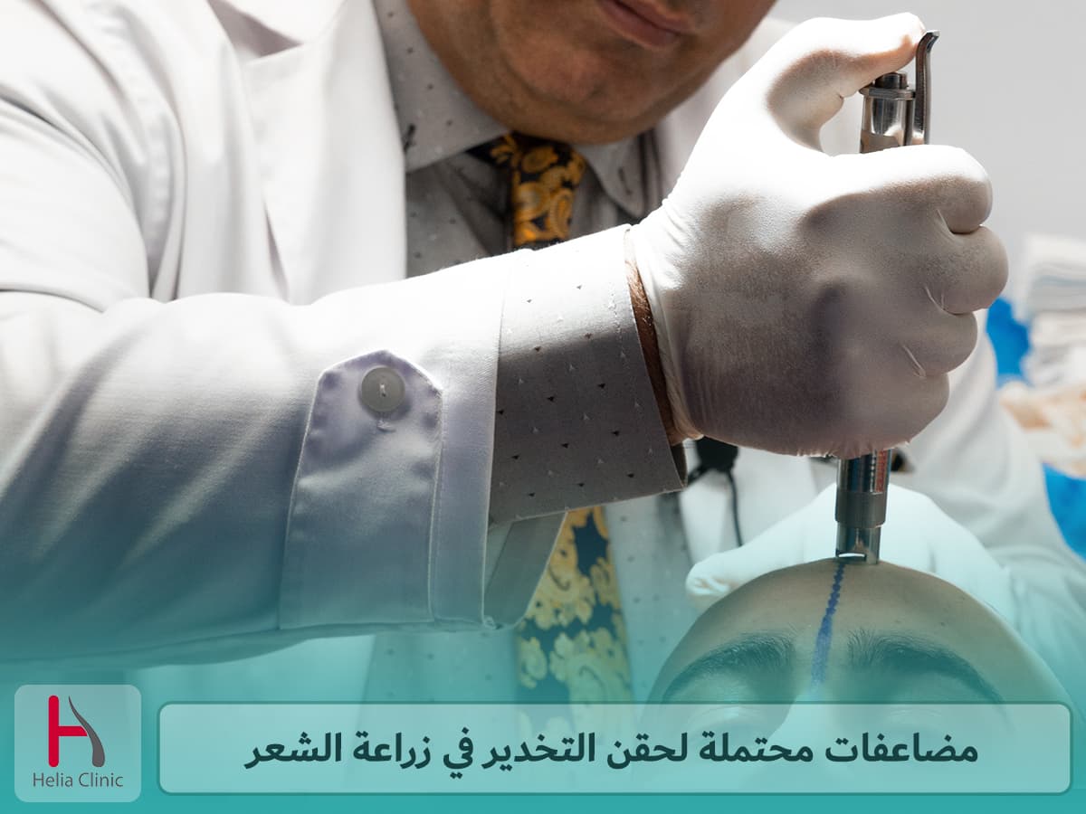 مضاعفات حقن التخدير لزراعة الشعر