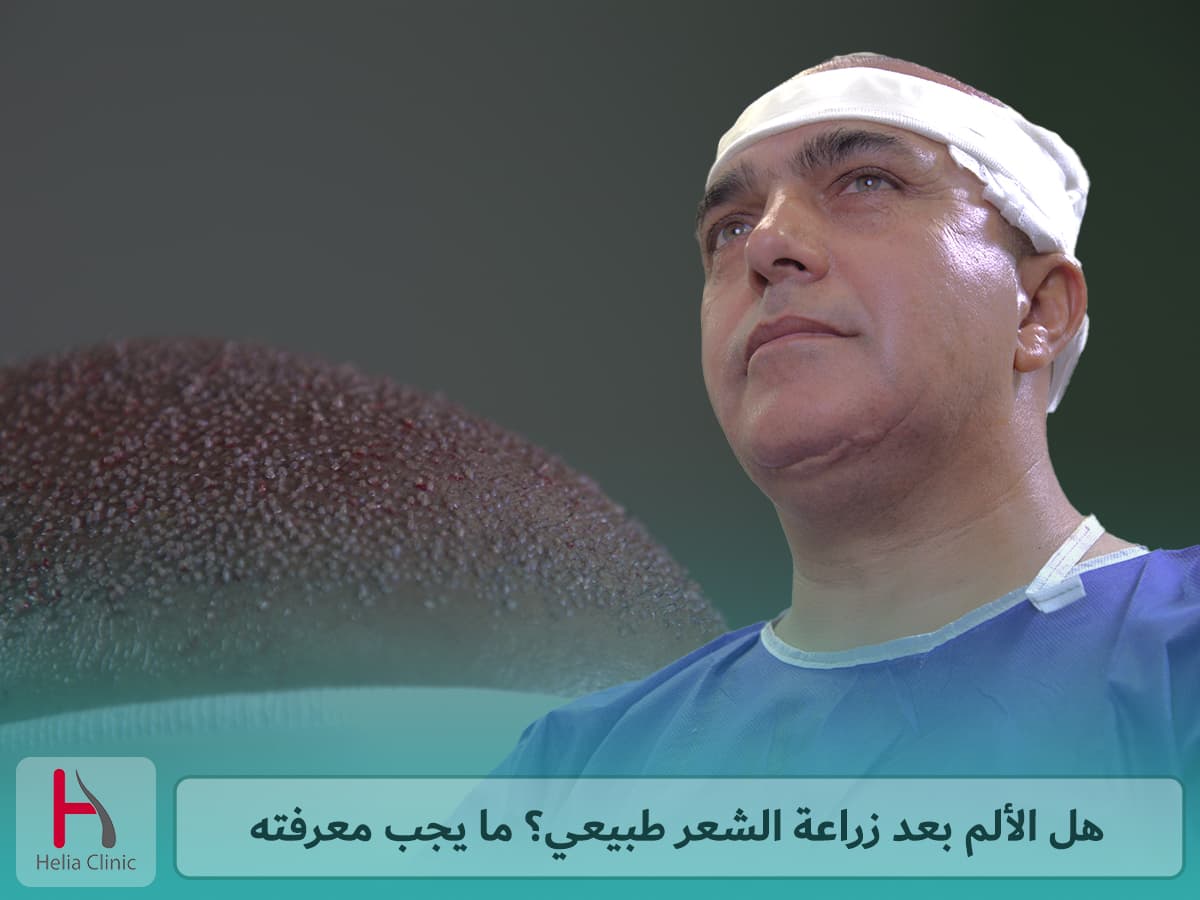 الألم بعد زراعة الشعر