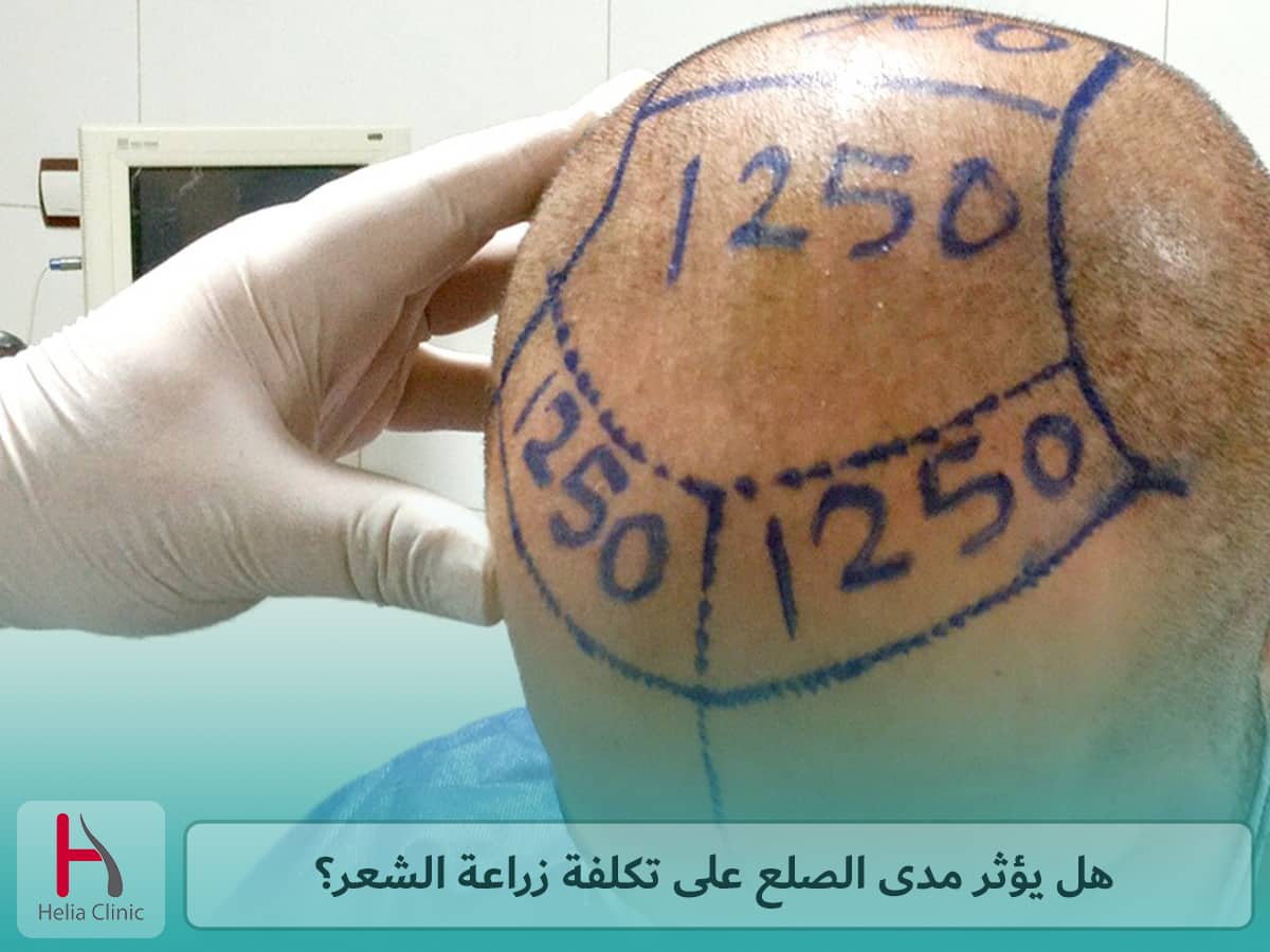 هل مناطق الزراعة فعالة من حيث التكلفة؟