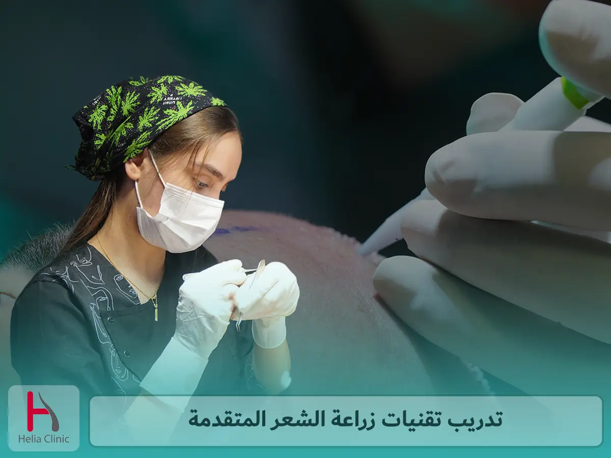 تدريب تقنيات زراعة الشعر المتقدمة