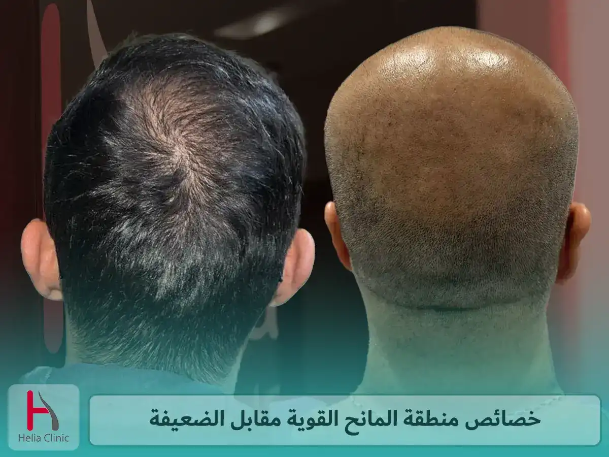 مميزات المنطقة المانحة القوية