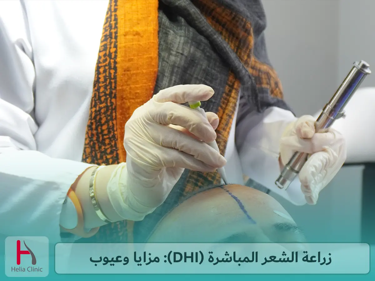 زراعة الشعر المباشرة (DHI): مزايا وعيوب