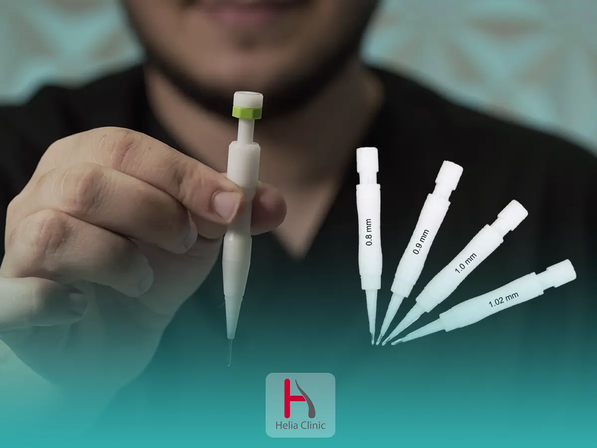 زراعة الشعر بأقلام تشوي (DHI)