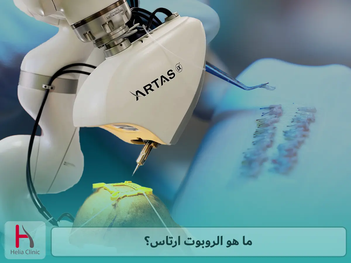 ما هو الروبوت ارتاس؟