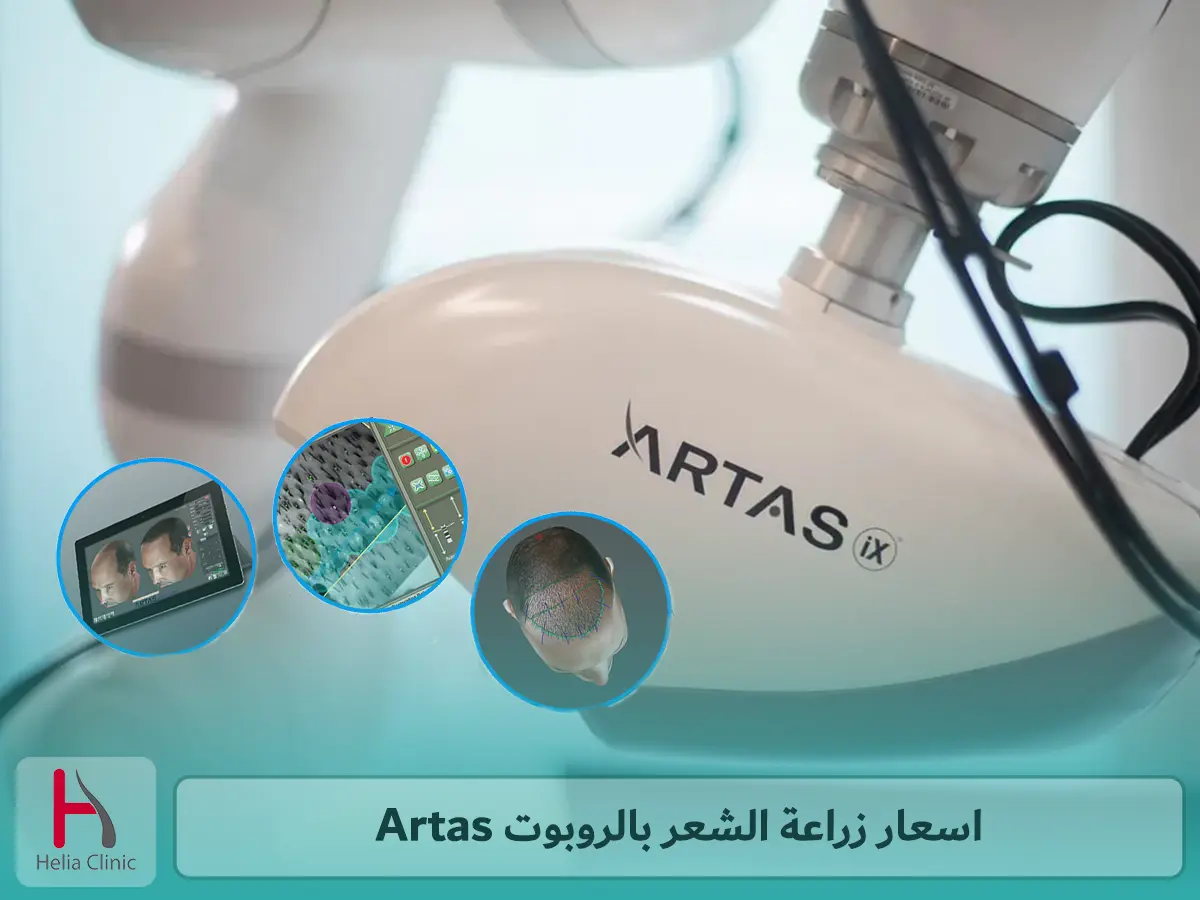 اسعار زراعة الشعر بالروبوت artas