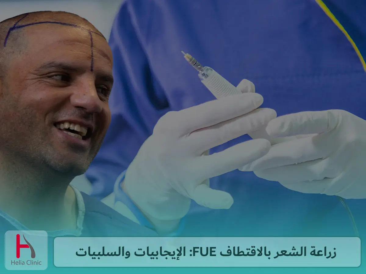 زراعة الشعر بالاقتطاف FUE: الإيجابيات والسلبيات