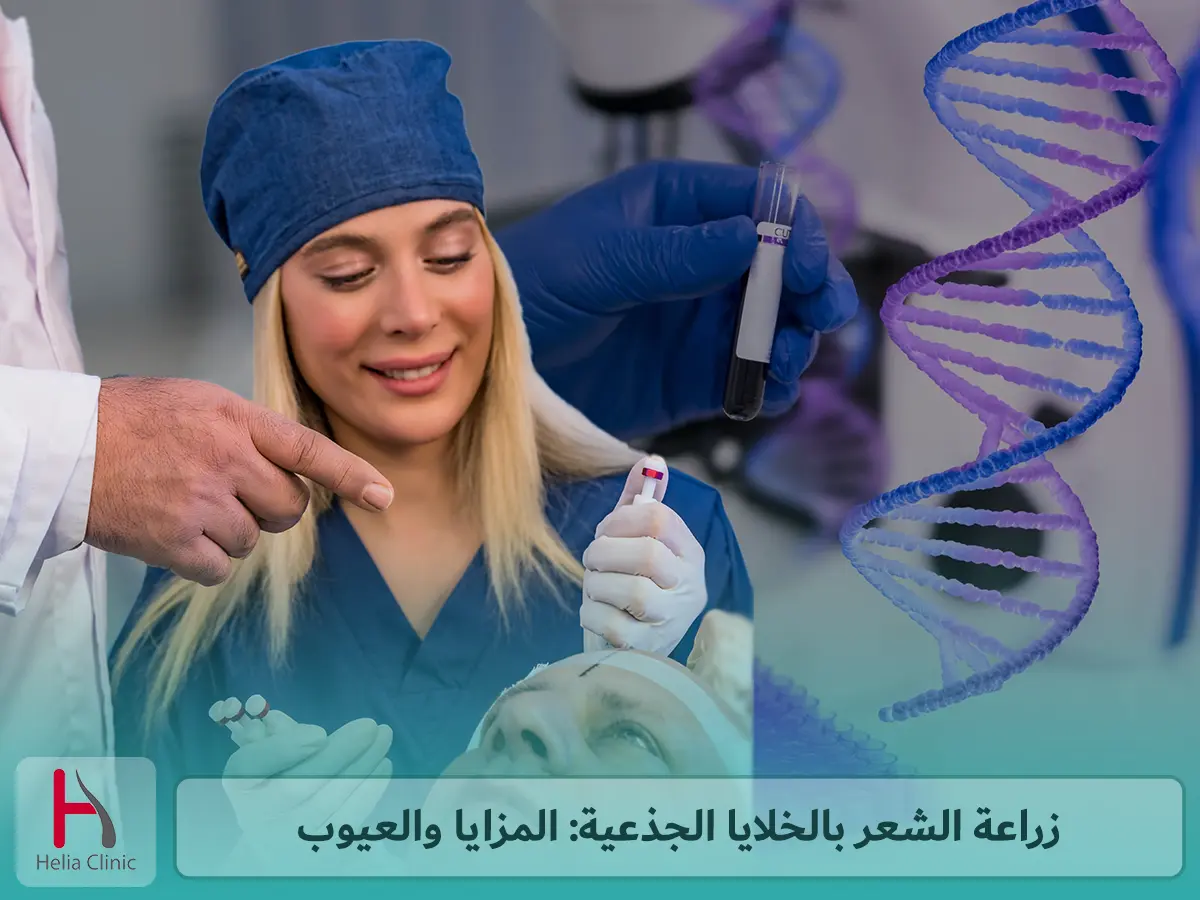زراعة الشعر بالخلايا الجذعية: المزايا والعيوب
