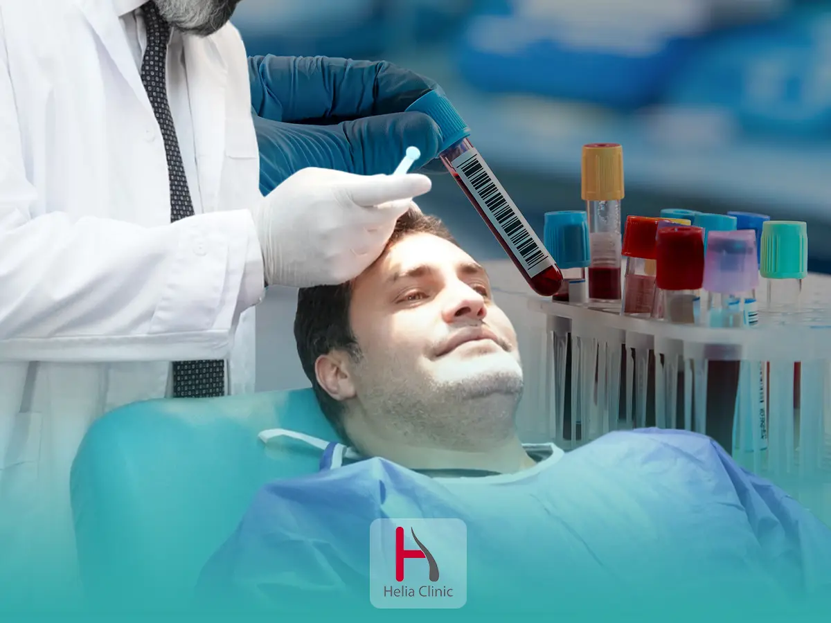 زراعة الشعر بالخلايا الجذعية