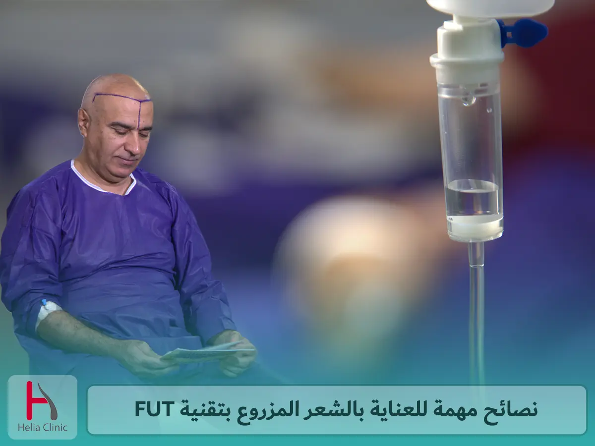 نصائح مهمة للعناية بالشعر المزروع بتقنية FUT