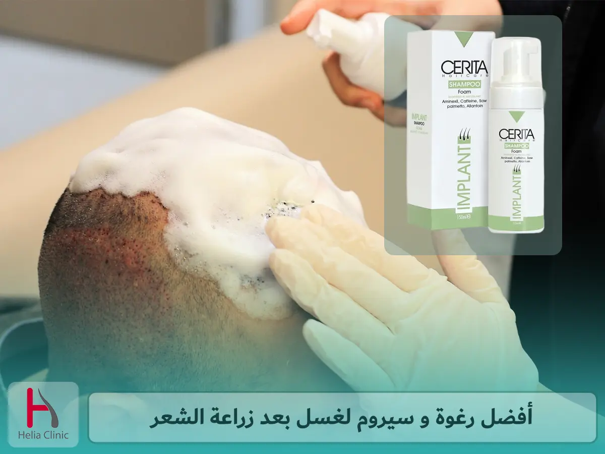 أفضل رغوة و سيروم لغسل بعد زراعة الشعر