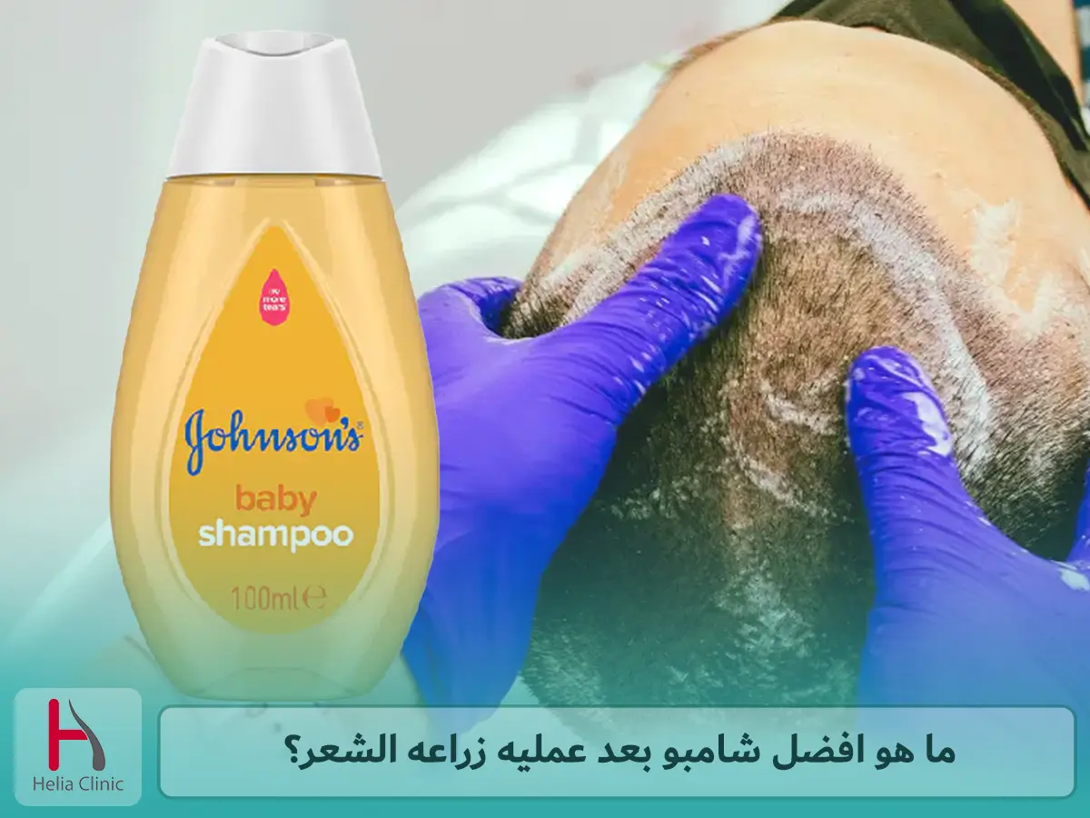 ما هو افضل شامبو بعد عمليه زراعه الشعر؟