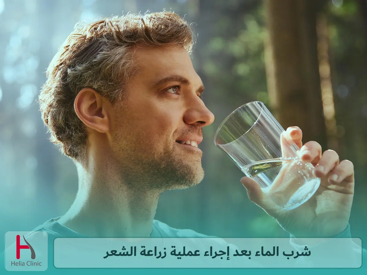 شرب الماء بعد إجراء عملية زراعة الشعر