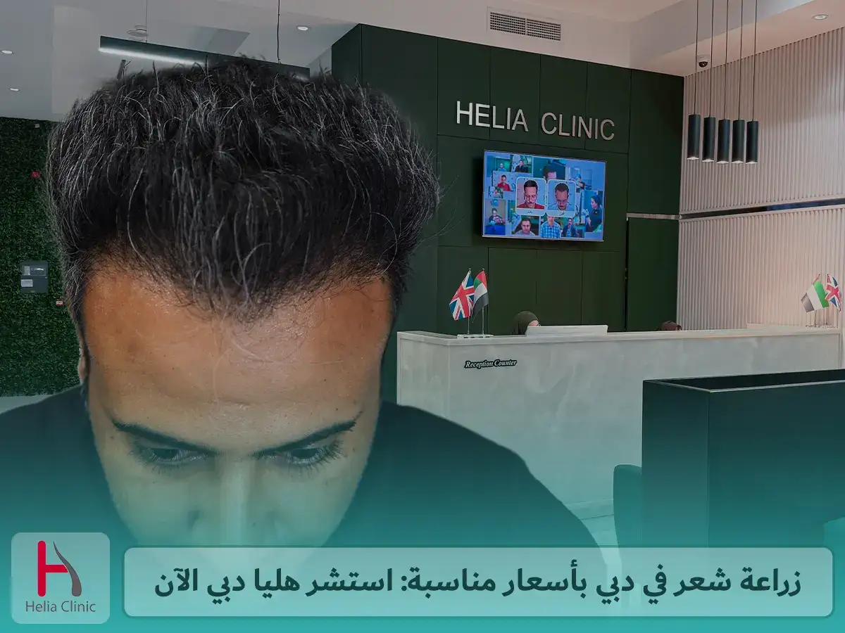 زراعة شعر في دبي بأسعار مناسبة: استشر هليا دبي الآن