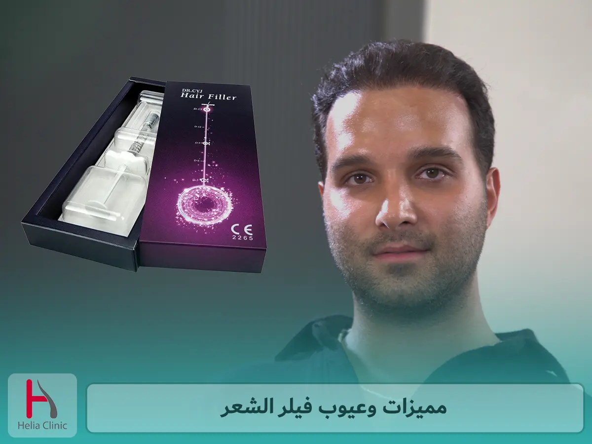 مميزات وعيوب فيلر الشعر