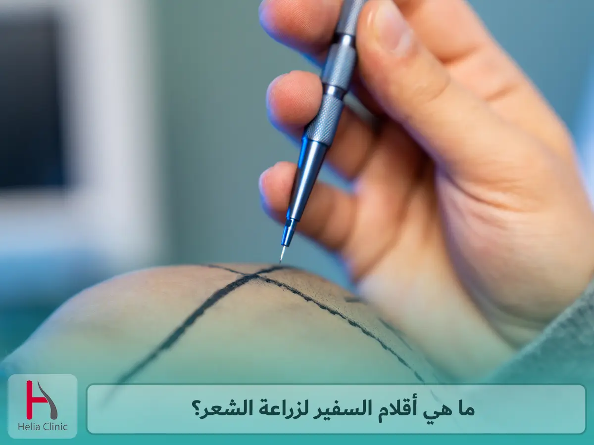 ما هي أقلام السفير لزراعة الشعر؟