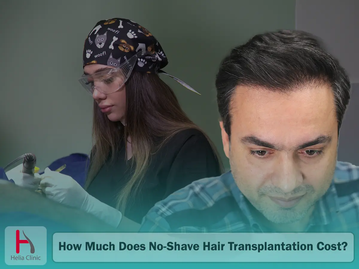 How Much Does No-Shave Hair Transplantation Cost?