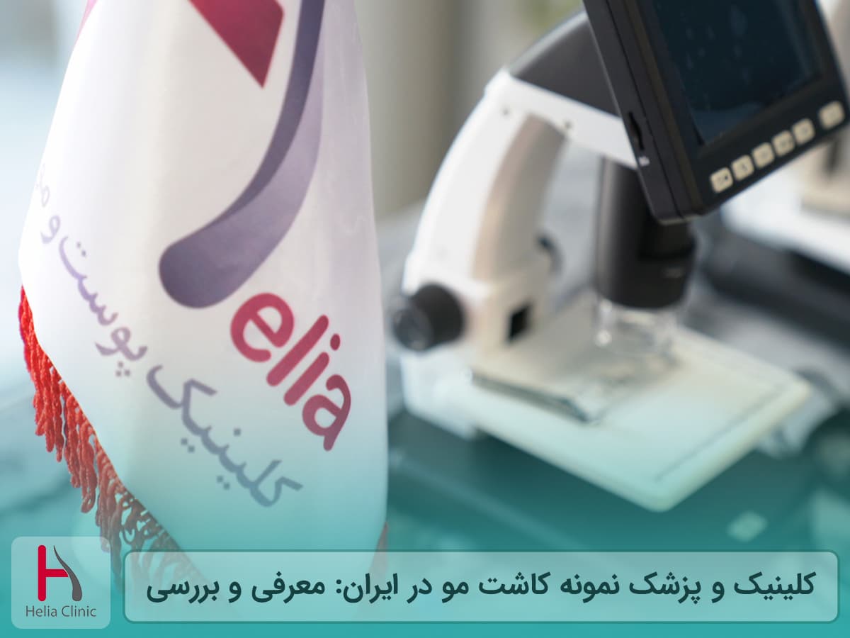 معرفی کلینیک و پزشک برتر کاشت مو در ایران