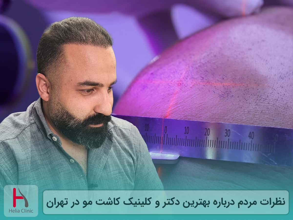 بهترین دکتر و کلینیک کاشت مو در تهران از نظر مردم