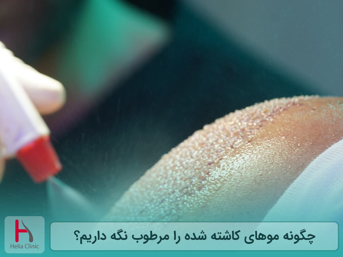 مرطوب نگه داشتن سر بعد از کاشت مو