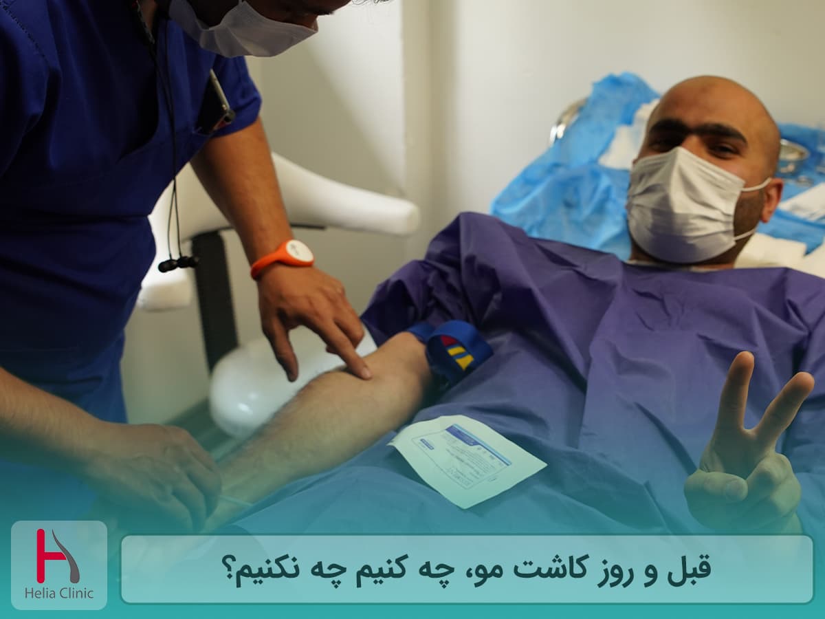 مهم ترین نکات مراقبتی قبل و روز کاشت مو