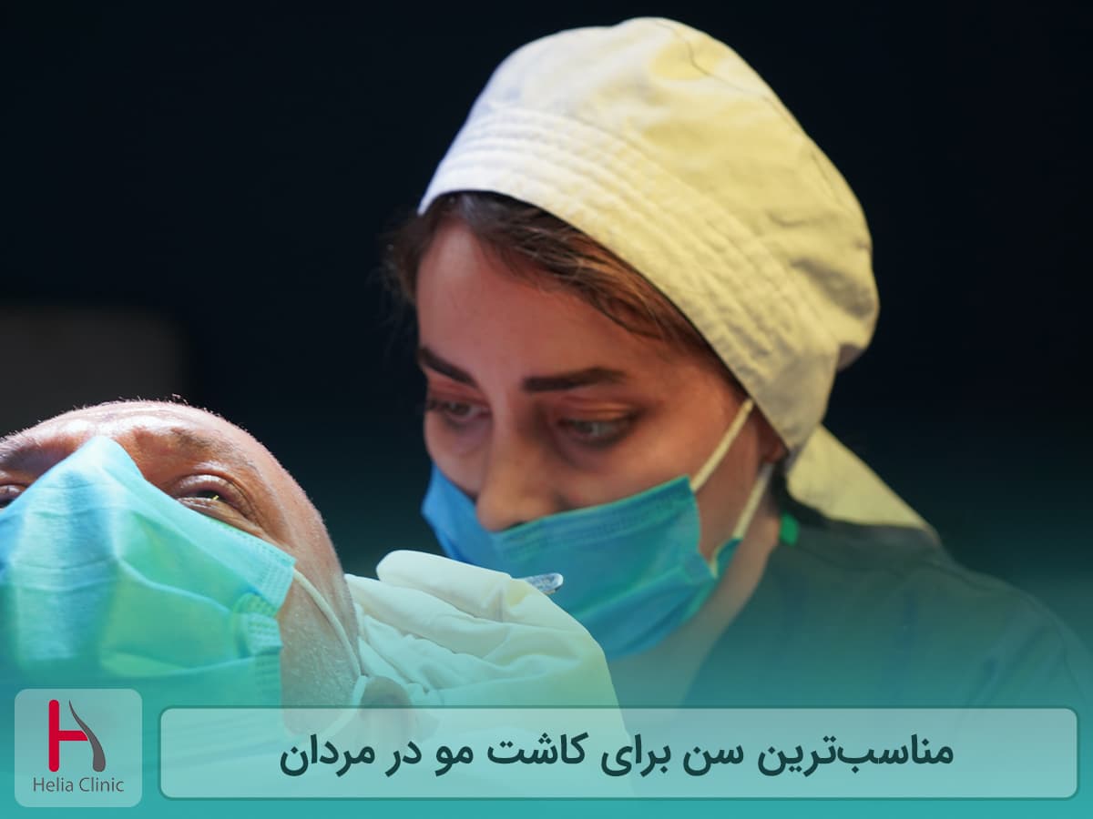 بهترین سن کاشت مو برای مردان