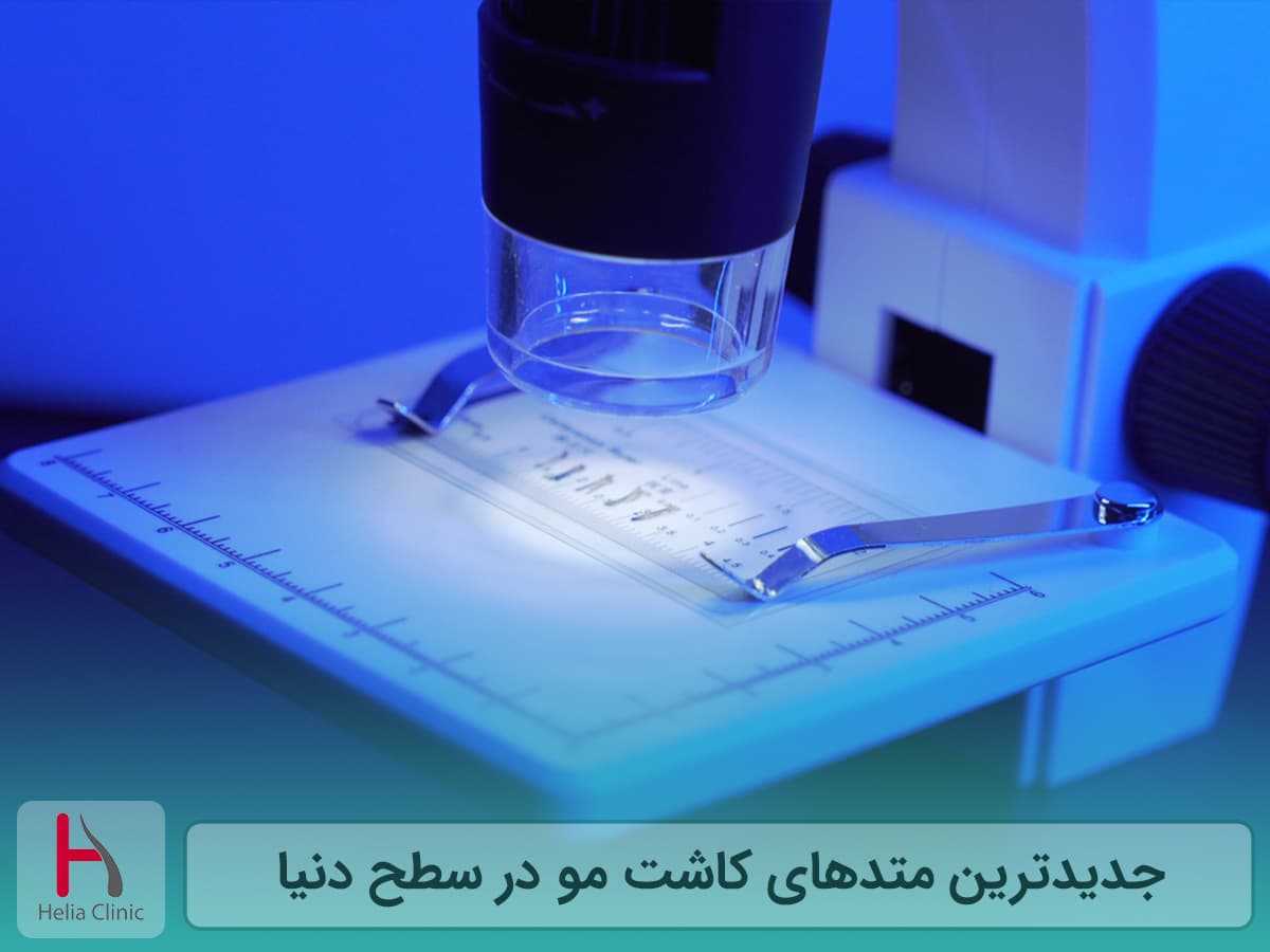 جدیدترین روش کاشت مو در جهان