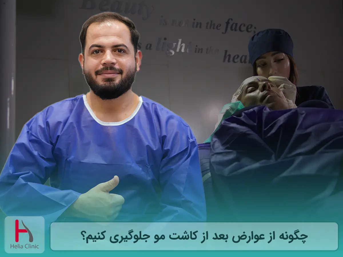 نکات مهم برای پیشگیری از عوارض کاشت مو