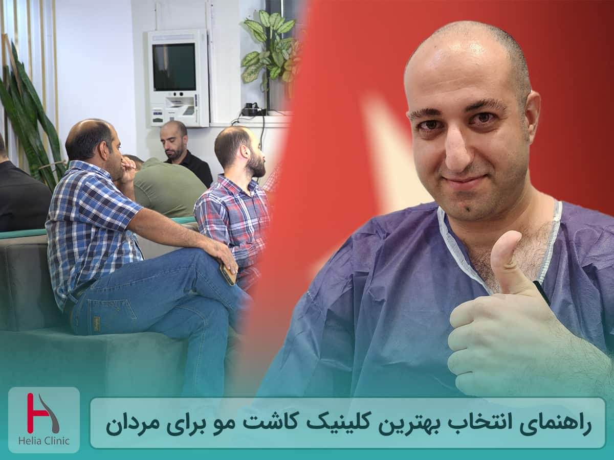 بهترین کلینیک کاشت مو برای آقایان