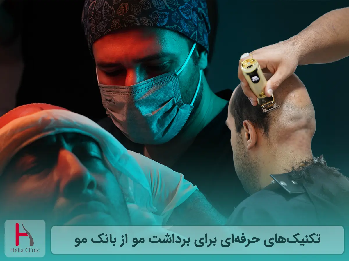 نحوه برداشت مو از بانک مو و پشت سر