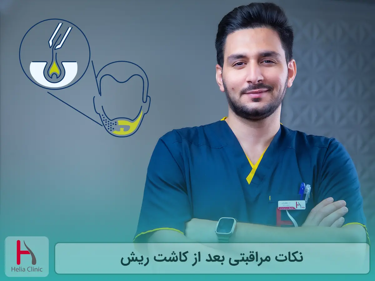 نکات مراقبتی بعد از کاشت ریش