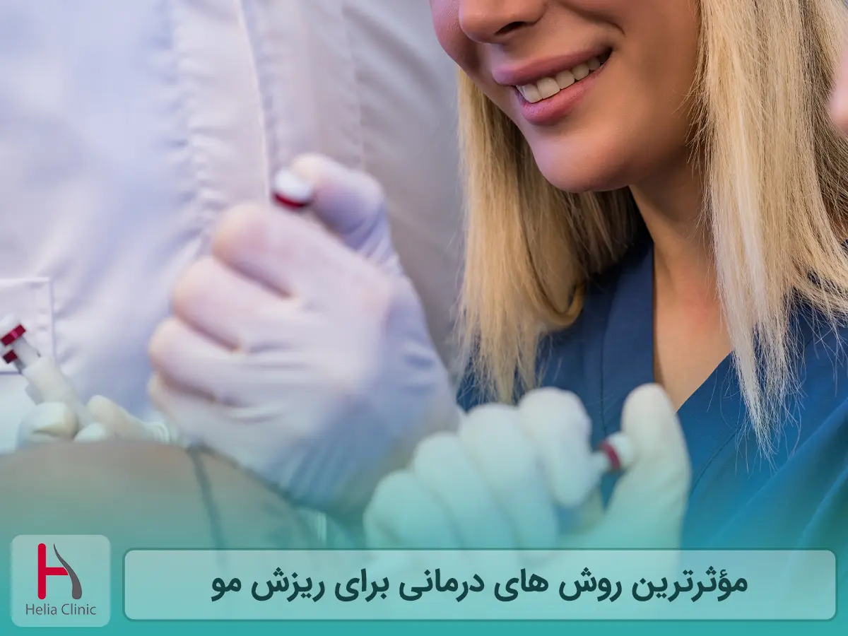 مؤثرترین روش های درمانی برای ریزش مو