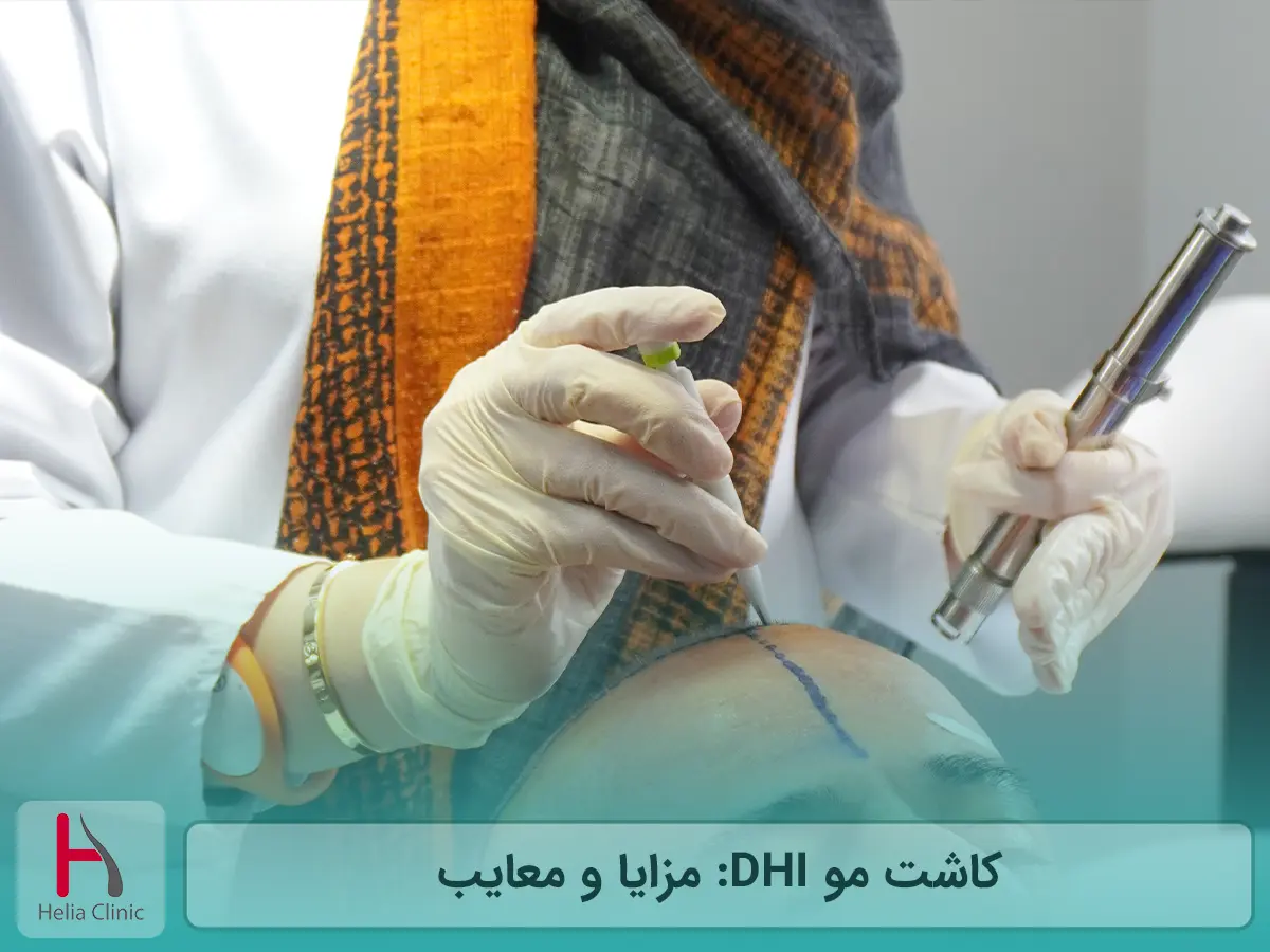 کاشت مو DHI: مزایا و معایب