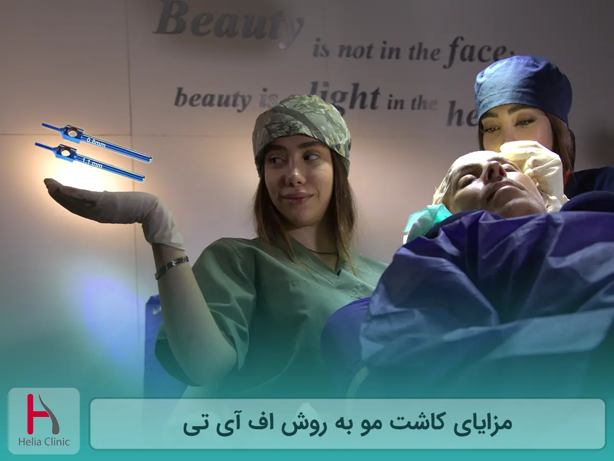 مزایا کاشت مو به روش اف آی تی