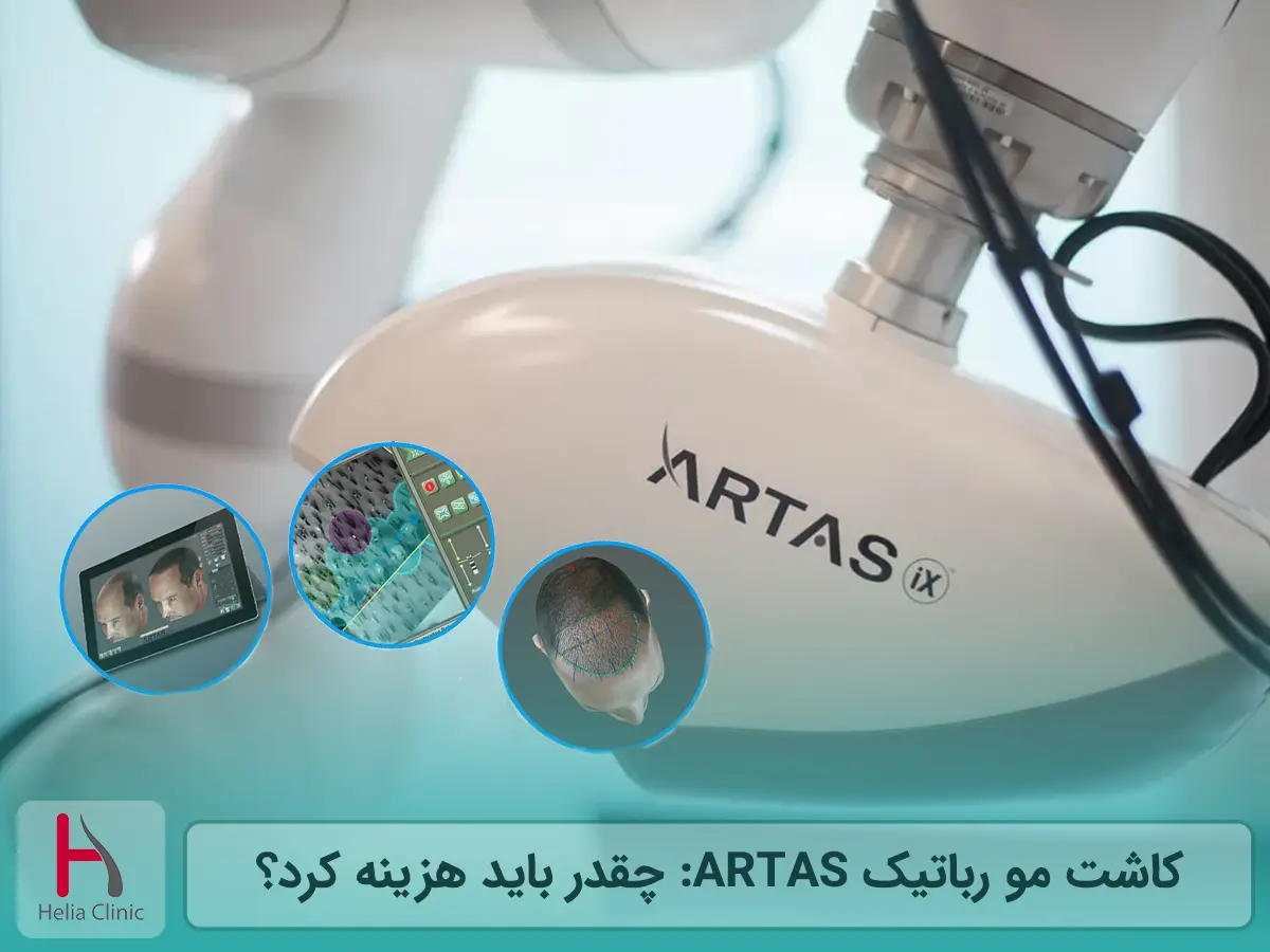 کاشت مو رباتیک ARTAS: چقدر باید هزینه کرد؟