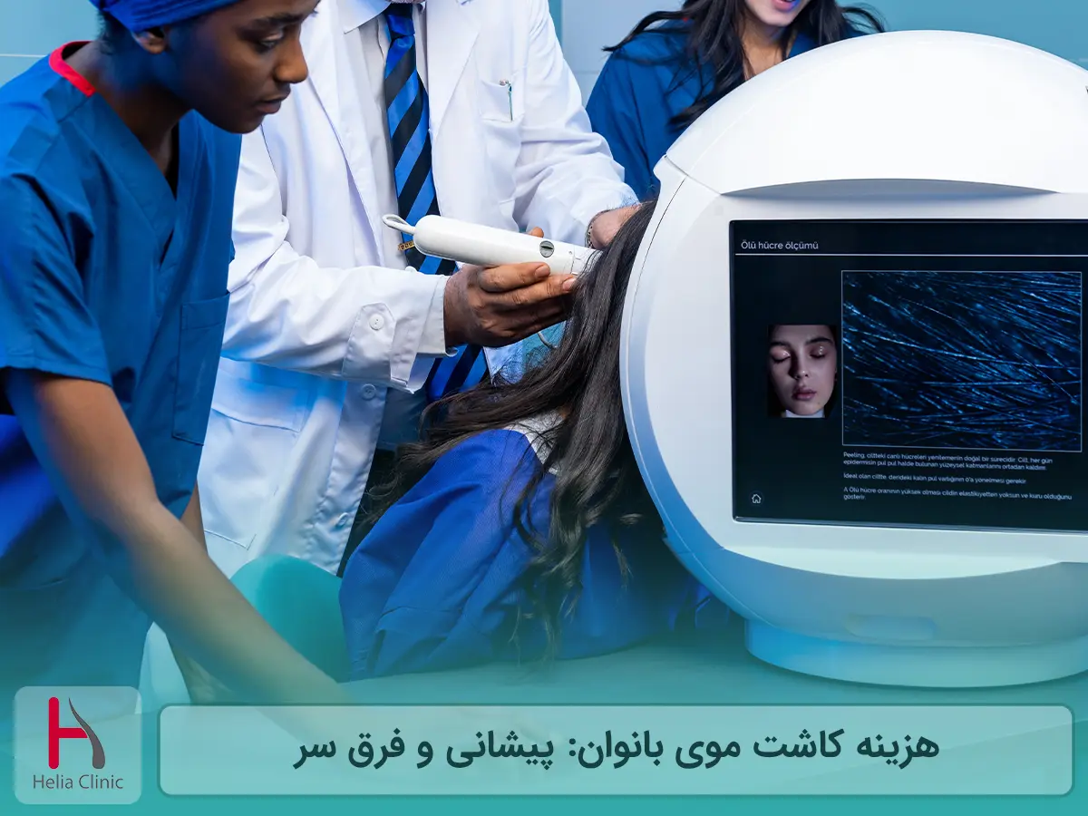 هزینه کاشت مو بانوان چقدر است؟ بررسی قیمت ها در تهران و ایران