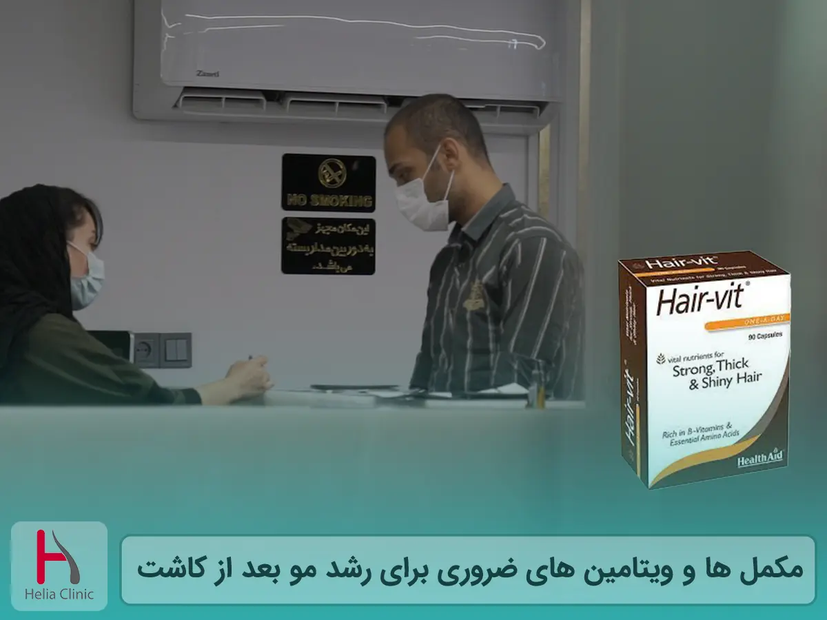 مکمل ها و ویتامین های ضروری برای رشد مو بعد از کاشت