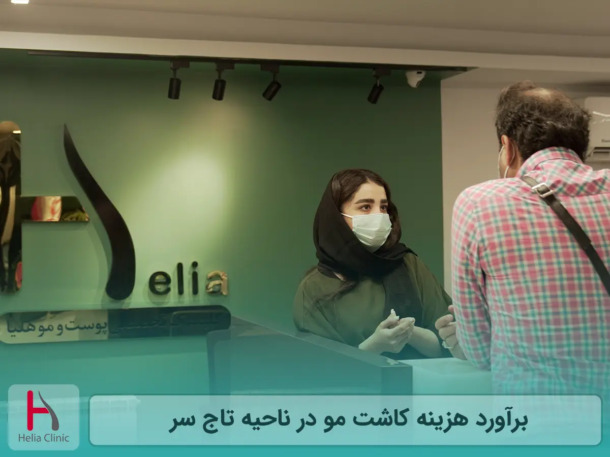 برآورد هزینه کاشت مو در ناحیه تاج سر