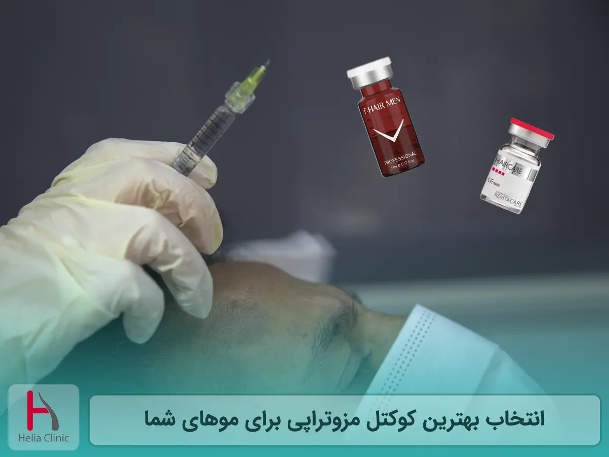 انتخاب بهترین کوکتل مزوتراپی برای موهای شما