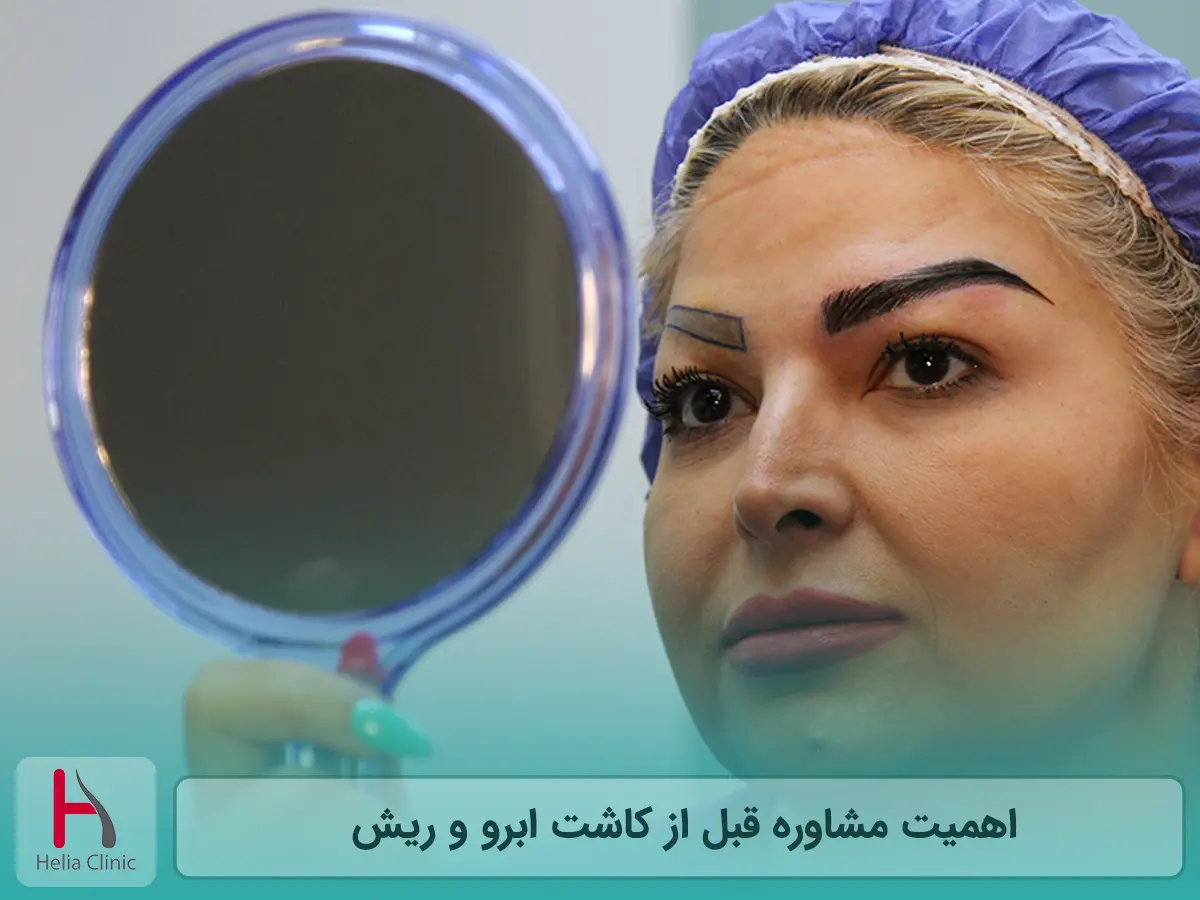 اهمیت مشاوره قبل از کاشت ابرو و ریش