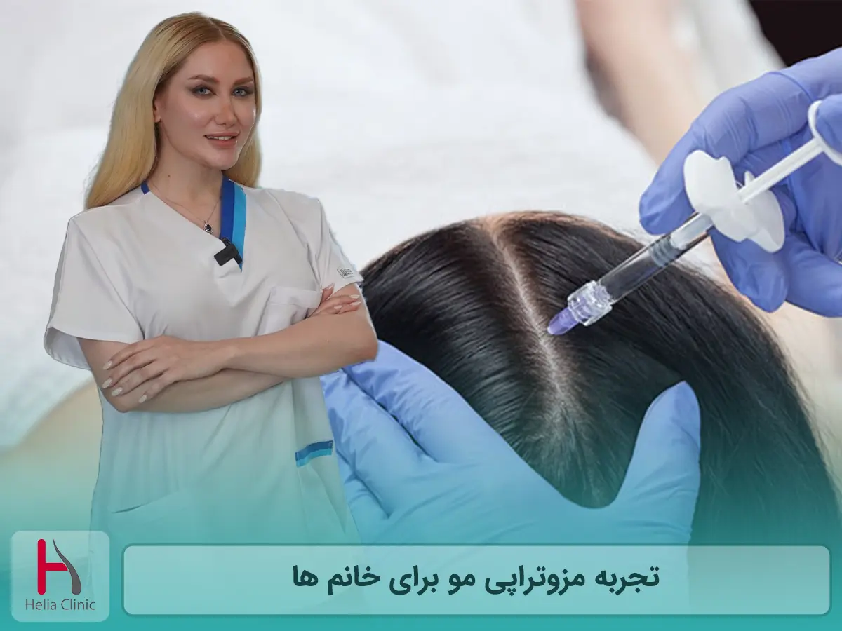 تجربه مزوتراپی مو برای خانم ها