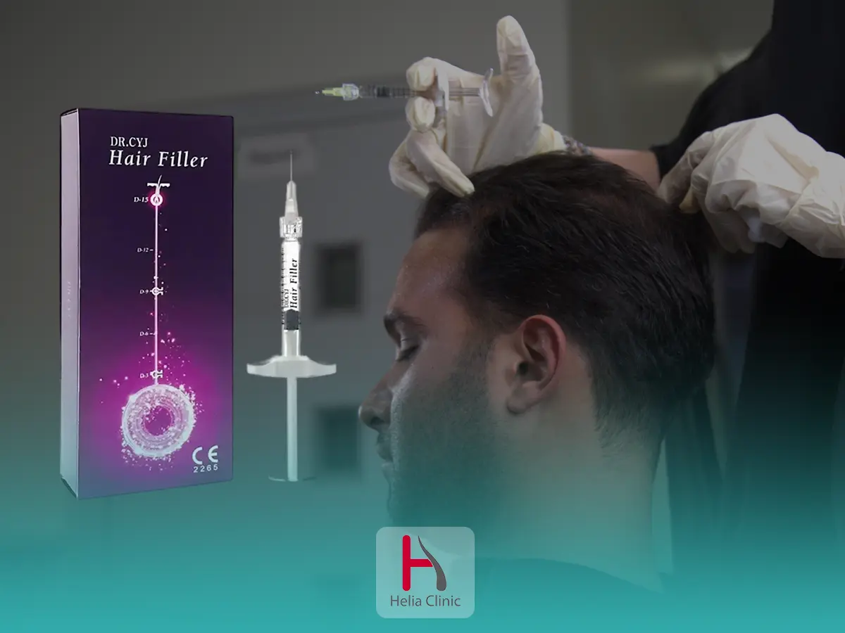 تزریق فیلر مو (Hair Filler)