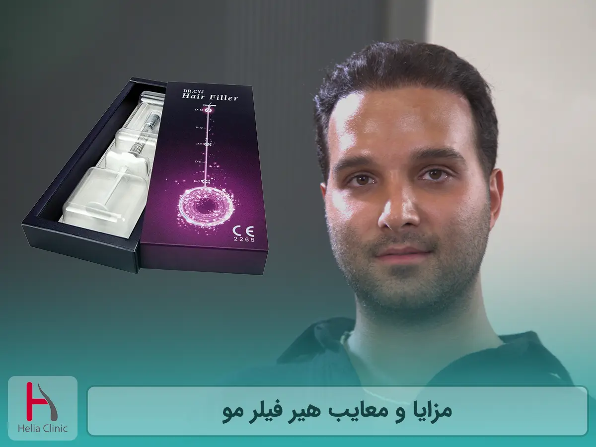 مزایا و معایب هیر فیلر مو