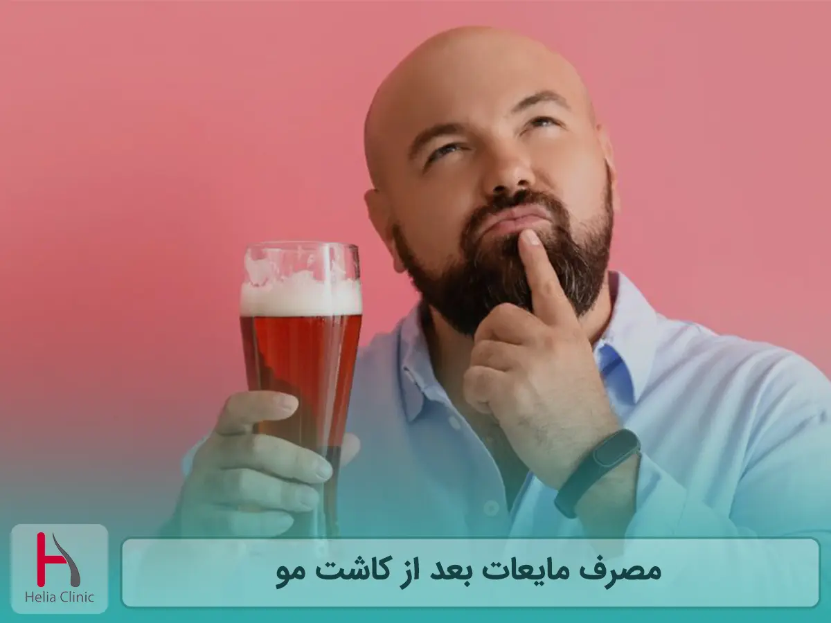 مصرف مایعات بعد از کاشت مو