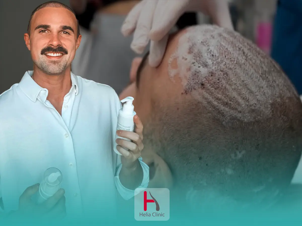 شستن موها بعد از کاشت مو
