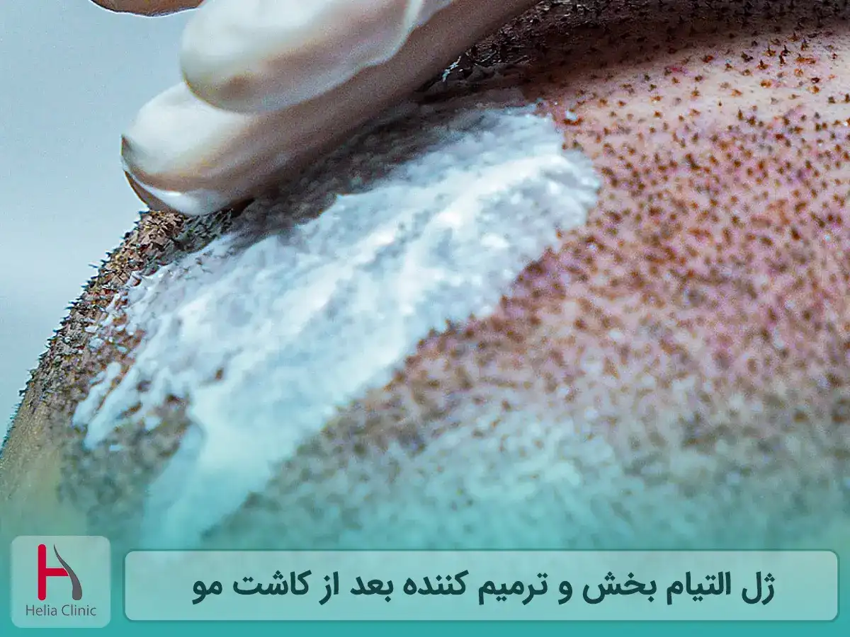 ژل التیام بخش و ترمیم کننده بعد از کاشت مو